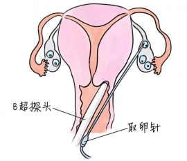 幼儿学画画，石家庄捐卵宝宝学画画，学画画的好处，如何学画画