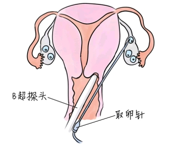 幼儿学画画，石家庄捐卵宝宝学画画，学画画的好处，如何学画画